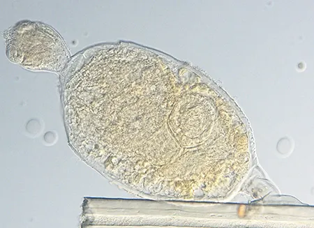 symbion pandora