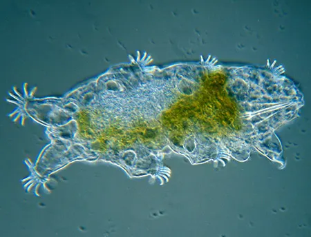 echiniscoides sigismundi